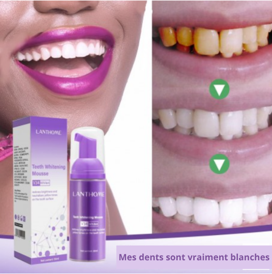Dentifrice Ultra-blanchissant - GlorySmile